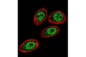 Confocal immunofluorescent analysis of PHB Antibody (Center) (ABIN389162 and ABIN2839329) with Hela cell followed by Alexa Fluor 488-conjugated goat anti-rabbit lgG (green). (Prohibitin 抗体  (AA 89-117))