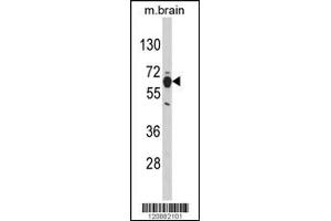 Western blot analysis of PHGDH Antibody in mouse brain tissue lysates (35ug/lane) (PHGDH 抗体  (N-Term))