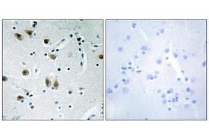 Immunohistochemistry analysis of paraffin-embedded human brain tissue using ZNF148 antibody. (ZNF148 抗体  (N-Term))