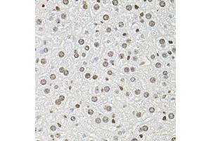 Immunohistochemistry of paraffin-embedded mouse liver using FOSL1 antibody. (FOSL1 抗体)