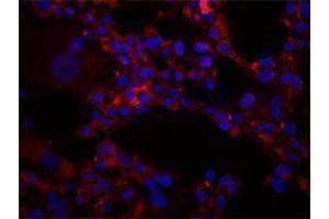 Immunofluorescence (IF) image for anti-Intercellular Adhesion Molecule 1 (ICAM1) antibody (ABIN2664764) (ICAM1 抗体)