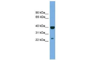 SOCS1 antibody used at 1 ug/ml to detect target protein. (SOCS1 抗体  (Middle Region))