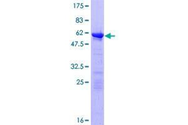 UBR7 Protein (AA 1-274) (GST tag)