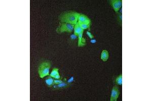 IF analysis of 14-3-3 sigma using anti-14-3-3 sigma antibody (ABIN5693156).