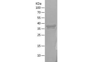 Western Blotting (WB) image for Cereblon (CRBN) (AA 1-80) protein (His-IF2DI Tag) (ABIN7122244) (CRBN Protein (AA 1-80) (His-IF2DI Tag))