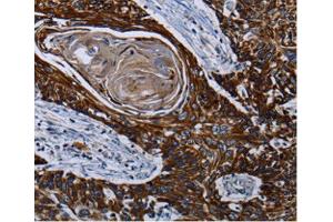 Immunohistochemistry (IHC) image for anti-Carnitine Palmitoyltransferase 2 (CPT2) antibody (ABIN3023424) (CPT2 抗体)
