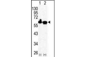 Western blot analysis of HDAC2 (arrow) using rabbit polyclonal HDAC2 Antibody (C-term) (ABIN6242378 and ABIN6577318). (HDAC2 抗体  (C-Term))