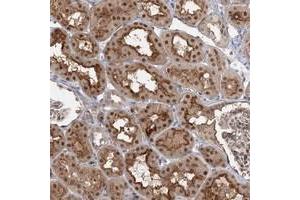 Immunohistochemical staining of human kidney with WDR44 polyclonal antibody  shows nuclear, cytoplasmic and membranous positivity in cells of tubules. (WDR44 抗体)