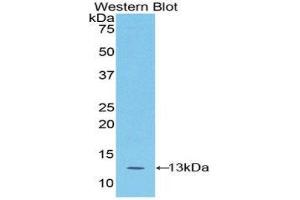 Western Blotting (WB) image for anti-S100 Calcium Binding Protein A4 (S100A4) (AA 1-101) antibody (ABIN1078504) (s100a4 抗体  (AA 1-101))