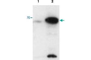 AIRE polyclonal antibody  staining (0. (AIRE 抗体)