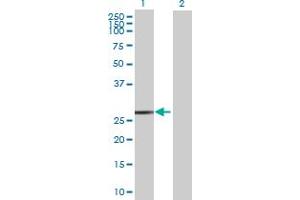 Western Blot analysis of FKBP3 expression in transfected 293T cell line by FKBP3 MaxPab polyclonal antibody. (FKBP3 抗体  (AA 1-224))