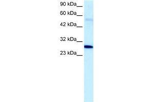 WB Suggested Anti-PAntibody Titration:  5. (PARP1 抗体  (C-Term))
