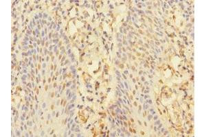 Immunohistochemistry of paraffin-embedded human tonsil tissue using ABIN7161343 at dilution of 1:100 (CHRNA1 抗体  (AA 25-240))