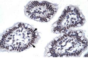 Immunohistochemistry (IHC) image for anti-Apoptosis Antagonizing Transcription Factor (AATF) (N-Term) antibody (ABIN2777467)
