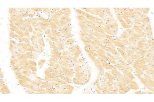 Immunohistochemistry (IHC) image for anti-HLA Class I Histocompatibility Antigen, alpha Chain E (HLA-E) (AA 22-358) antibody (ABIN7434017)