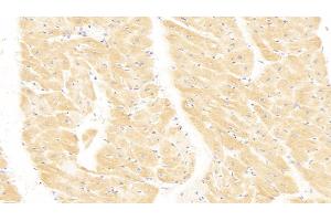 Detection of MHCE in Human Heart Tissue using Polyclonal Antibody to Major Histocompatibility Complex Class I E (MHCE)