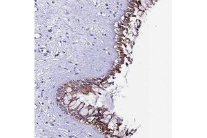 Immunohistochemical staining of human nasopharynx with UGT2A2 polyclonal antibody ( Cat # PAB28013 ) shows moderate cytoplasmic positivity in respiratory epithelial cells at 1:20 - 1:50 dilution. (UGT2A1 抗体)