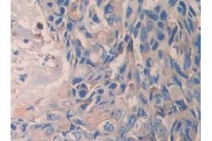 Immunohistochemistry (IHC) image for anti-Phenylalanine Hydroxylase (AA 228-452) antibody (ABIN7438214)