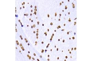 Immunohistochemistry (IHC) image for anti-Histone 3 (H3) (H3K9me3) antibody (ABIN3016030)