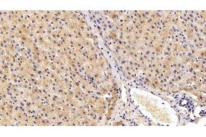 Detection of NEU in Porcine Liver Tissue using Polyclonal Antibody to Neuraminidase (NEU) (NEU1 抗体  (AA 47-415))