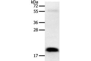 Western Blot analysis of Human colon cancer tissue using PTN Polyclonal Antibody at dilution of 1:600 (Pleiotrophin 抗体)
