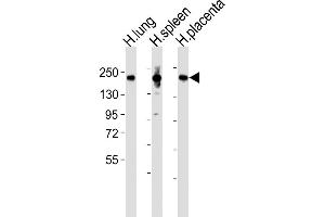 All lanes : Anti-MRC1L1 Antibody (N-term) at 1:2000 dilution Lane 1: human lung lysates Lane 2: human spleen lysates Lane 3: human placenta lysates Lysates/proteins at 20 μg per lane. (Macrophage Mannose Receptor 1 抗体  (N-Term))