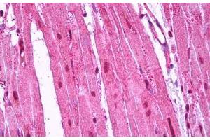 Anti-RRAS antibody IHC staining of human heart. (R-Ras 抗体)