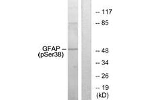 Western blot analysis of extracts from HeLa cells, using GFAP (Phospho-Ser38) Antibody. (GFAP 抗体  (pSer38))