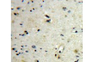 Used in DAB staining on fromalin fixed paraffin-embedded Brain tissue (CGB 抗体  (AA 31-165))