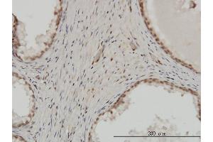Immunoperoxidase of monoclonal antibody to ZNF202 on formalin-fixed paraffin-embedded human prostate. (ZNF202 抗体  (AA 301-400))