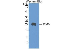 Western Blotting (WB) image for anti-Growth Arrest and DNA-Damage-Inducible, beta (GADD45B) (AA 1-160) antibody (ABIN2116595) (GADD45B 抗体  (AA 1-160))