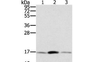 Western Blot analysis of Hela, hepg2 and PC3 cell using PPIA Polyclonal Antibody at dilution of 1:300 (PPIA 抗体)