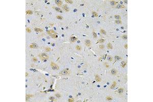 Immunohistochemistry of paraffin-embedded rat brain using RRAGC Antibody (ABIN5975563) at dilution of 1/100 (40x lens). (GTR2 抗体)