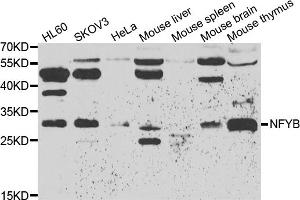 Western blot analysis of extracts of various cell lines, using NFYB antibody (ABIN5974397) at 1/500 dilution. (NFYB 抗体)