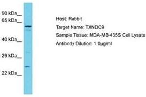 Image no. 1 for anti-Thioredoxin Domain Containing 9 (TXNDC9) (N-Term) antibody (ABIN6750580)
