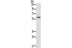 Gel: 8 % SDS-PAGE, Lysate: 40 μg, Lane: Human placenta tissue, Primary antibody: ABIN7191225(KLHL8 Antibody) at dilution 1/200, Secondary antibody: Goat anti rabbit IgG at 1/8000 dilution, Exposure time: 10 seconds (KLHL8 抗体)