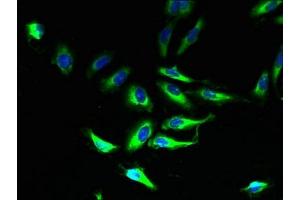 Immunofluorescent analysis of Hela cells using ABIN7160433 at dilution of 1:100 and Alexa Fluor 488-congugated AffiniPure Goat Anti-Rabbit IgG(H+L) (PLP1 抗体  (AA 143-197))