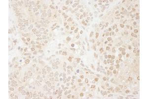 Immunohistochemistry (IHC) image for anti-Drosha, Ribonuclease Type III (DROSHA) (AA 1050-1100) antibody (ABIN7448535)