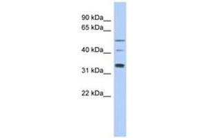 TCP11 anticorps  (AA 143-192)