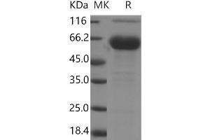 Western Blotting (WB) image for Folate Receptor 1 (Adult) (FOLR1) protein (Fc Tag) (ABIN7195834) (FOLR1 Protein (Fc Tag))