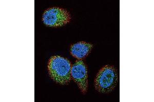Immunofluorescence (IF) image for anti-HRas proto-oncogene, GTPase (HRAS) antibody (ABIN3003478) (HRAS 抗体)