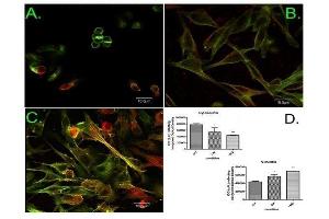 Image kindly submitted by Dr. (Fascin 抗体  (pSer39))