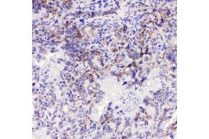 IHC analysis of Integrin alpha 3 using anti-Integrin alpha 3 antibody (ABIN6719410). (ITGA3 抗体)