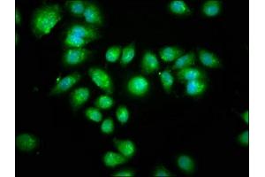 Immunofluorescence staining of A549 cells with ABIN7169324 at 1:133, counter-stained with DAPI. (AANAT 抗体  (AA 1-207))