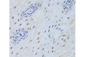 Immunohistochemistry of paraffin-embedded Human esophagus using TARDBP Polyclonal Antibody at dilution of 1:200 (40x lens). (TARDBP 抗体)