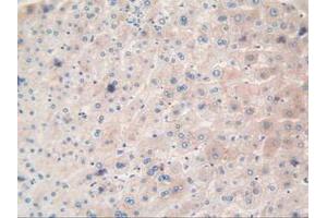 IHC-P analysis of Human Liver Tissue, with DAB staining. (TTR 抗体  (AA 21-147))