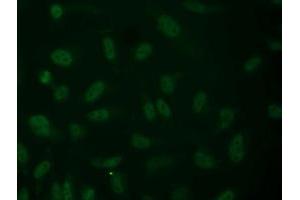 Anti-ALDH1L1 mouse monoclonal antibody (ABIN2452748) immunofluorescent staining of COS7 cells transiently transfected by pCMV6-ENTRY ALDH1L1 (RC213720). (ALDH1L1 抗体)