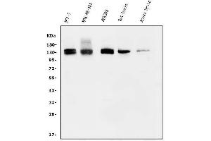 Western blot analysis of KIBRA/WWC1 using anti-KIBRA/WWC1 antibody (ABIN7602724). (WWC1 抗体  (AA 990-1080))