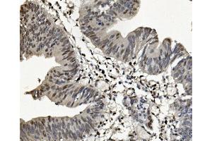 IHC analysis of SAMHD1 using anti-SAMHD1 antibody (ABIN7601516).