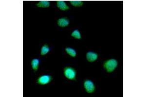 ICC/IF analysis of SET7/9 in HeLa cells line, stained with DAPI (Blue) for nucleus staining and monoclonal anti-human SET7/9 antibody (1:100) with goat anti-mouse IgG-Alexa fluor 488 conjugate (Green). (SET7/9 抗体)